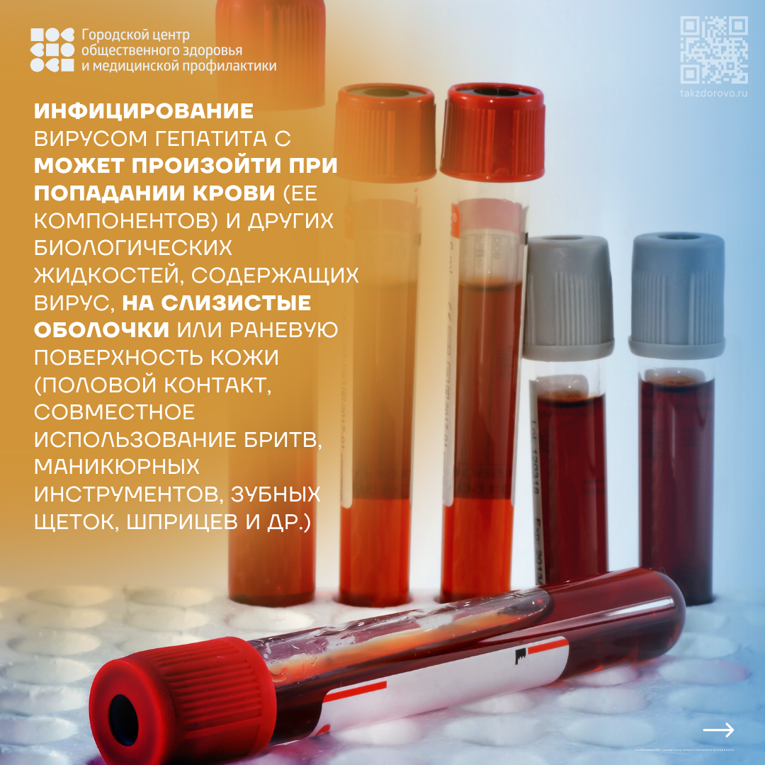 Симптомы гепатита С